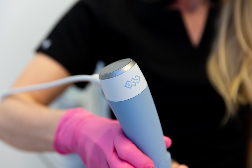 Provider holds handheld device for RF microneedling near Weddington to stimulate collagen production and improve patient's skin texture